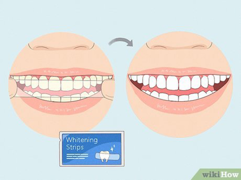 How to Assess Your Smile  